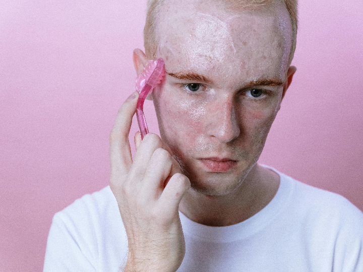 acne papulopustuloso que es y como tratarlo