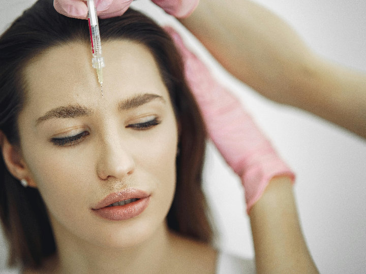 botox preventivo por que y para quien