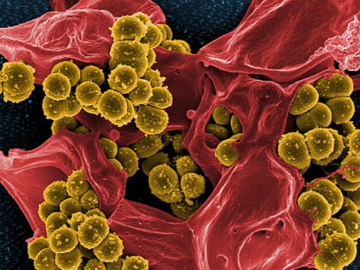 margan dextrociso infecciones urinarias 90 capsulas