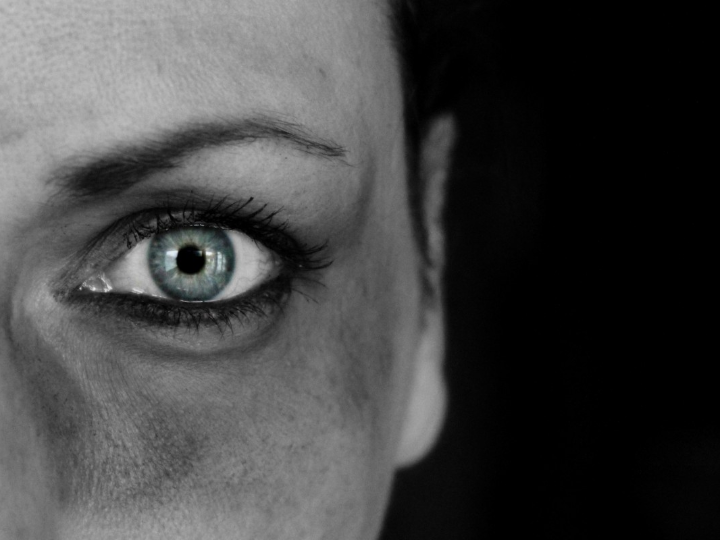 todo sobre los contornos de ojos de casmara